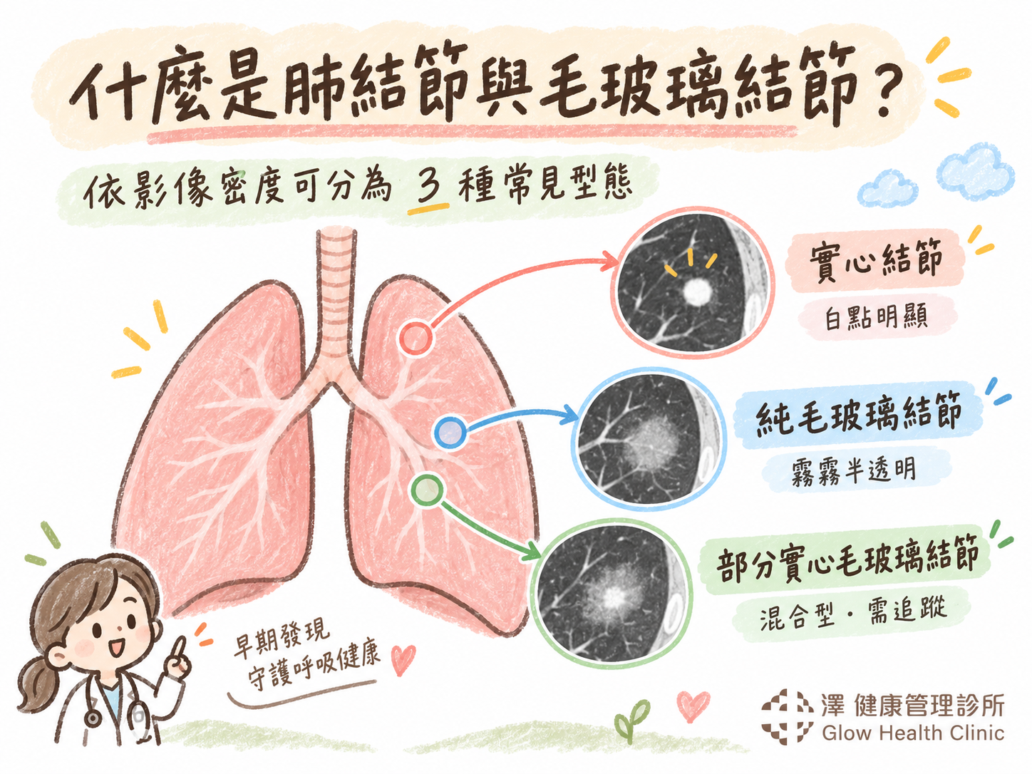 什麼是肺結節與毛玻璃結節? 澤健康管理診所