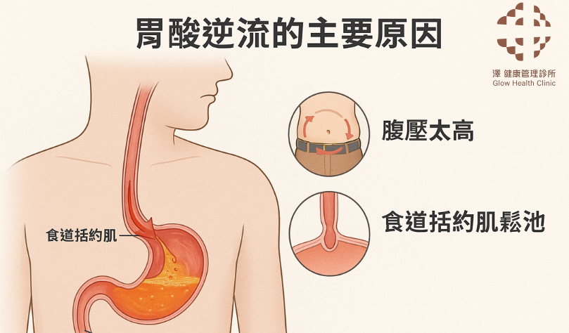 胃酸逆流的原因