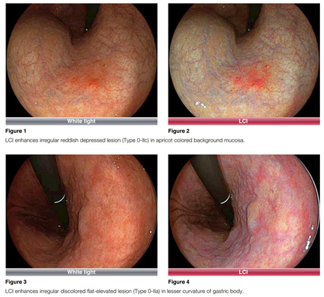 FUJIFILM 7000內視鏡